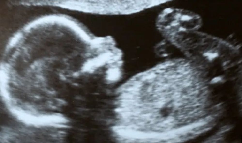 Deutschland: Abtreibungen in den ersten 12 Wochen sollten legalisiert werden